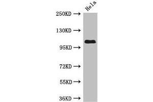 Western Blot Positive WB detected in: Hela whole cell lysate All lanes: USP33 antibody at 3 μg/mL Secondary Goat polyclonal to rabbit IgG at 1/50000 dilution Predicted band size: 107, 104, 94 kDa Observed band size: 107 kDa