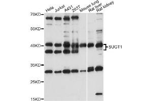 Western blot analysis of extracts of various cell lines, using SUGT1 antibody (ABIN6293563) at 1:1000 dilution. (SUGT1 抗体)