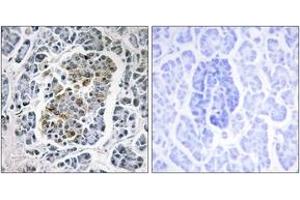 Immunohistochemistry analysis of paraffin-embedded human pancreas tissue, using MtSSB Antibody. (SSBP1 抗体  (AA 99-148))