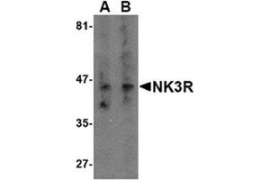 Image no. 1 for anti-Tachykinin Receptor 3 (TACR3) (Middle Region) antibody (ABIN318919) (TACR3 抗体  (Middle Region))