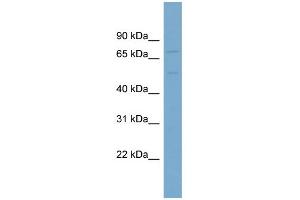 WB Suggested Anti-SLC7A1 Antibody Titration:  0. (SLC7A1 抗体  (N-Term))