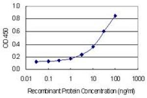 Detection limit for recombinant GST tagged FIGN is 0. (Fidgetin 抗体  (AA 77-170))