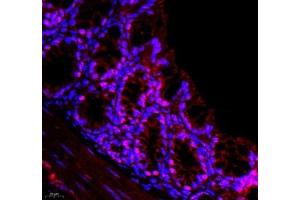 Immunofluorescence of paraffin embedded mouse colon using DMRTA2 (ABIN7073753) at dilution of 1: 650 (400x lens) (DMRTA2 抗体)