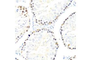 Immunohistochemistry of paraffin-embedded mouse testis using DDX50 antibody (ABIN6129371, ABIN6139509, ABIN6139510 and ABIN6224730) at dilution of 1:100 (40x lens). (DDX50 抗体  (AA 1-135))