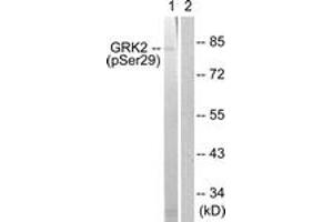 Western blot analysis of extracts from Jurkat cells treated with EGF 200ng/ml 30', using GRK2 (Phospho-Ser29) Antibody. (GRK2 抗体  (pSer29))