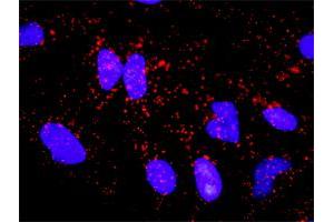 Proximity Ligation Analysis of protein-protein interactions between NEFL and APP. (NEFL 抗体  (AA 1-543))