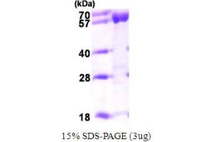 SDS-PAGE (SDS) image for Acyl-CoA Dehydrogenase, Very Long Chain (ACADVL) (AA 41-655) protein (His tag) (ABIN667811) (ACADVL Protein (AA 41-655) (His tag))