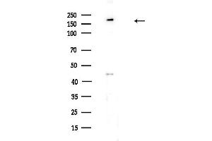 Western blot analysis of lysates from HUVEC cells(UV,30 min treatment), using PTPN23 Antibody at 1/1000 dilution.