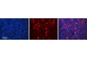 Rabbit Anti-MFN2 Antibody   Formalin Fixed Paraffin Embedded Tissue: Human Heart Tissue Observed Staining: Cytoplasm in cardiomyocytes Primary Antibody Concentration: 1:100 Other Working Concentrations: N/A Secondary Antibody: Donkey anti-Rabbit-Cy3 Secondary Antibody Concentration: 1:200 Magnification: 20X Exposure Time: 0. (MFN2 抗体  (C-Term))