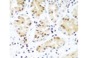 Immunohistochemistry of paraffin-embedded Human stomach using Argonaute-2 Polyclonal Antibody at dilution of 1:100 (40x lens). (AGO2 抗体)