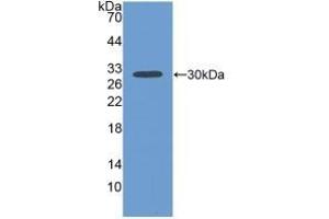 Detection of Recombinant FBLN1, Human using Polyclonal Antibody to Fibulin 1 (FBLN1) (Fibulin 1 抗体  (AA 176-398))