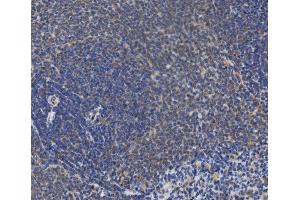 IHC analysis of IRAK2 using anti-IRAK2 antibody (ABIN7602761).