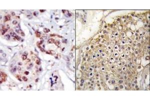 Image no. 2 for anti-Phosphatidylinositol-5-Phosphate 4-Kinase, Type II, gamma (PIP4K2C) (C-Term) antibody (ABIN360486)