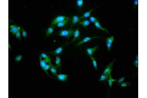 Immunofluorescence staining of Hela cells with ABIN7161797 at 1:155, counter-stained with DAPI. (NFATC3 抗体  (AA 887-1070))