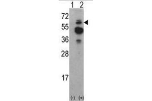 Image no. 1 for anti-tyrosine Kinase, Non-Receptor, 2 (TNK2) (N-Term) antibody (ABIN452711) (TNK2 抗体  (N-Term))