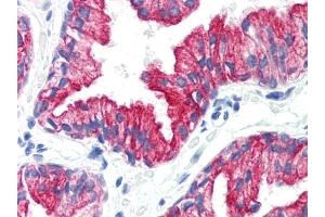 Immunohistochemistry staining of human prostate (paraffin sections) using anti-cytokeratin 8(C-43). (KRT8 抗体)