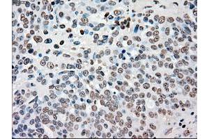 Image no. 6 for anti-Checkpoint Kinase 2 (CHEK2) antibody (ABIN1497497)