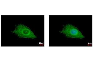 ICC/IF Image FIG4 antibody detects FIG4 protein at cytoplasm by immunofluorescent analysis. (FIG4 抗体  (Center))