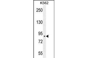 CLIC6 Antibody (Center) (ABIN654431 and ABIN2844167) western blot analysis in K562 cell line lysates (35 μg/lane). (CLIC6 抗体  (AA 539-565))