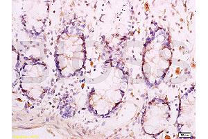 Formalin-fixed and paraffin embedded human rectal tissue labeled with Anti-Adiponectin Receptor 1 Polyclonal Antibody (ABIN670836), Unconjugated at 1:300, followed by conjugation to the secondary antibody and DAB staining (Adiponectin Receptor 1 抗体  (AA 241-270))