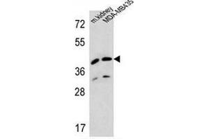 Western blot analysis in MDA-MB435 cell line and mouse kidney tissue lysates (35ug/lane) using L2HGDH/Duranin Antibody . (L2HGDH 抗体  (Middle Region))