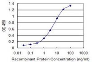 Detection limit for recombinant GST tagged CCRK is 0. (CCRK 抗体  (AA 183-257))