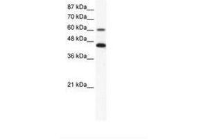 Image no. 1 for anti-Annexin A6 (ANXA6) (AA 28-77) antibody (ABIN203241) (ANXA6 抗体  (AA 28-77))
