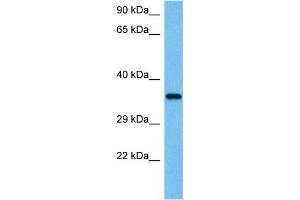 Host:  Mouse  Target Name:  WNT4  Sample Tissue:  Mouse Testis  Antibody Dilution:  1ug/ml (WNT4 抗体  (Middle Region))