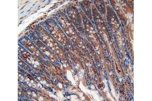 Immunohistochemistry (IHC) image for anti-Alanine Aminotransferase (ALT) (AA 720-961) antibody (ABIN1857852)