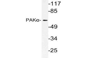 Western blot (WB) analysis of PAKalpha antibody in extracts from 3T3 cells. (PAK1 抗体)