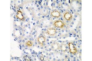 Immunohistochemistry of paraffin-embedded Rat kidney using RARRES2 Polyclonal Antibody at dilution of 1:200 (40x lens). (Chemerin 抗体)