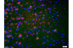 Formalin-fixed and paraffin-embedded rat brain labeled with Anti-NKA/Neurokinin A Polyclonal Antibody, Unconjugated (ABIN724445) 1:200, overnight at 4°C, The secondary antibody was Goat Anti-Rabbit IgG, Cy3 conjugated used at 1:200 dilution for 40 minutes at 37°C. (NKA 抗体  (AA 98-107))
