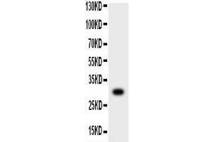 Anti-MMP7 Picoband antibody,  All lanes: Anti-MMP7 at 0. (MMP7 抗体  (AA 95-264))