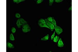 Immunofluorescence (IF) image for anti-Runt-Related Transcription Factor 1 (RUNX1) (AA 211-445) antibody (ABIN7168481)
