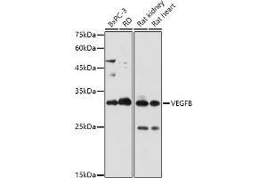 Western blot analysis of extracts of various cell lines, using VEGFB antibody (ABIN7271298) at 1:1000 dilution. (VEGFB 抗体  (AA 25-207))