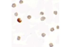 Immunocytochemistry of SDHAF1 in 3T3 cells with SDHAF1 antibody at 5 ug/mL. (SDHAF1 抗体  (C-Term))