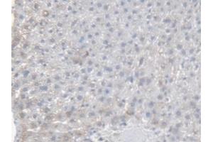 Detection of CES1 in Rat Liver Tissue using Polyclonal Antibody to Carboxylesterase 1 (CES1) (CES1 抗体  (AA 19-300))