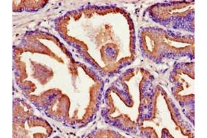 Immunohistochemistry of paraffin-embedded human prostate tissue using ABIN7157208 at dilution of 1:100 (Kallikrein 2 抗体  (AA 25-261))
