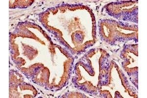 Immunohistochemistry of paraffin-embedded human prostate tissue using ABIN7157208 at dilution of 1:100 (Kallikrein 2 抗体  (AA 25-261))