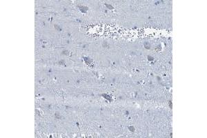 Immunohistochemical staining of human lateral ventricle with BFSP2 polyclonal antibody  shows weak cytoplasmic positivity in neuronal cells. (BFSP2 抗体)