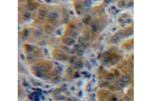 IHC-P analysis of Liver tissue, with DAB staining. (A1BG 抗体  (AA 22-219))