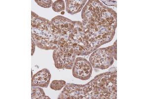 Immunohistochemical analysis of B on paraffin-embedded Human placenta tissue. (WDR41 抗体  (C-Term))