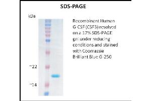 SDS-PAGE (SDS) image for Colony Stimulating Factor 3 (Granulocyte) (CSF3) (Active) protein (ABIN5509310) (G-CSF 蛋白)