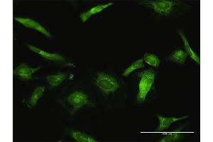 Immunofluorescence of purified MaxPab antibody to USP10 on HeLa cell. (USP10 抗体  (AA 1-798))