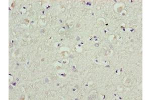 Immunohistochemistry of paraffin-embedded human brain tissue using ABIN7145267 at dilution of 1:100 (BATF2 抗体  (AA 1-189))