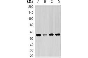 Western blot analysis of IMPDH2 expression in Hela (A), PC3 (B), mouse spleen (C), mouse heart (D) whole cell lysates.