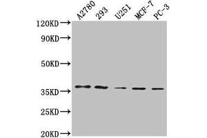 Western Blot Positive WB detected in: A2780 whole cell lysate, 293 whole cell lysate, U251 whole cell lysate, MCF-7 whole cell lysate, PC-3 whole cell lysate All lanes: PDCL3 antibody at 1:2000 Secondary Goat polyclonal to rabbit IgG at 1/50000 dilution Predicted band size: 28 kDa Observed band size: 37 kDa