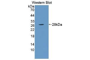 Western blot analysis of the recombinant protein. (Oligophrenin 1 抗体  (AA 634-802))