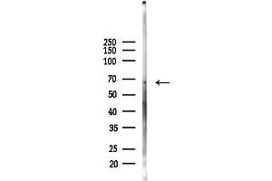Western blot analysis of lysates from Mouse lung, using AHCYL2 Antibody at 1/1000 dilution.