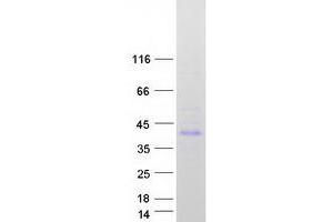 Estrogen Receptor Binding Site Associated, Antigen, 9 (EBAG9) (Transcript Variant 2) protein (Myc-DYKDDDDK Tag)
